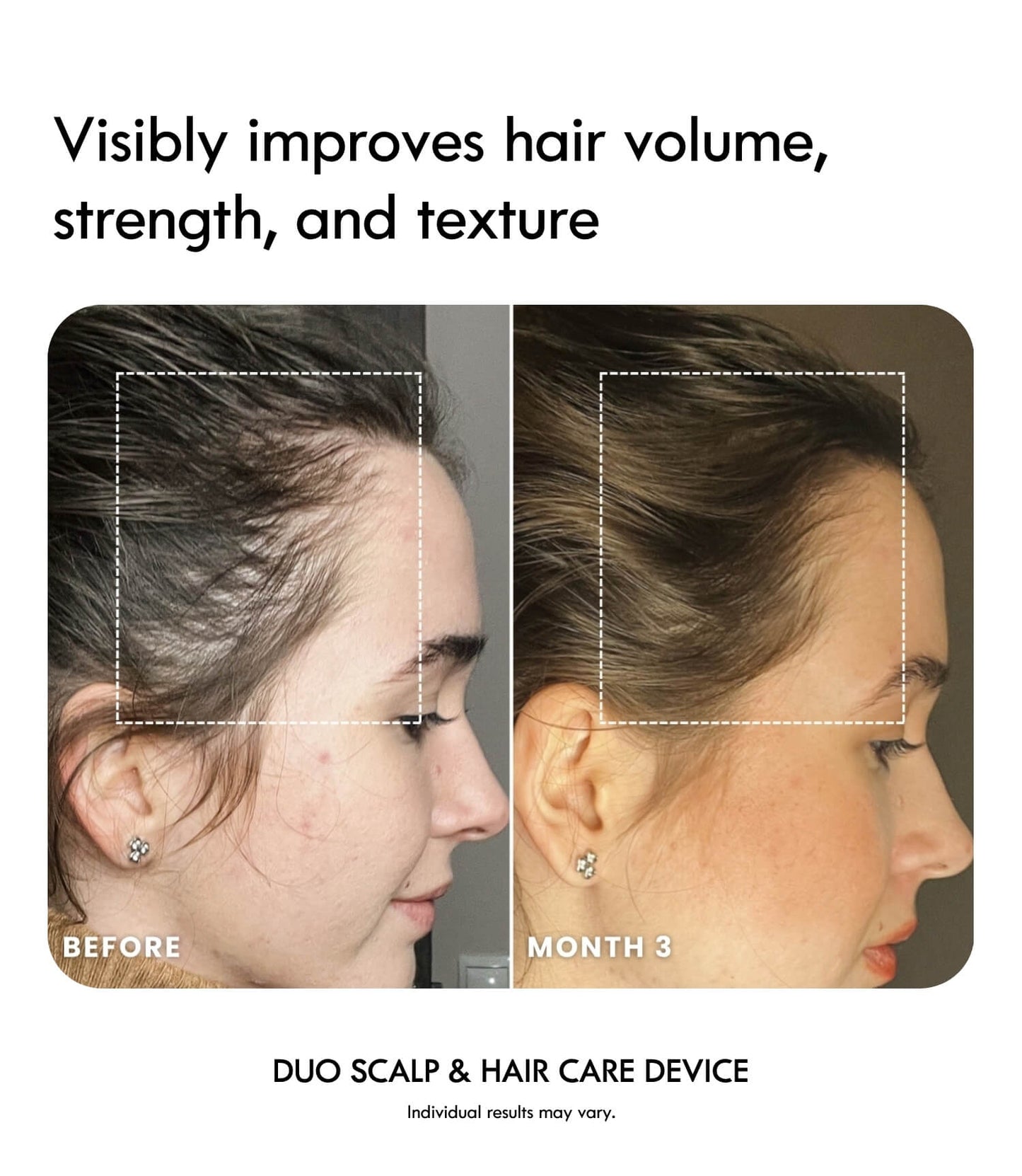 Laduora DUO 4-in-1 Pod Based Scalp & Hair Care Device